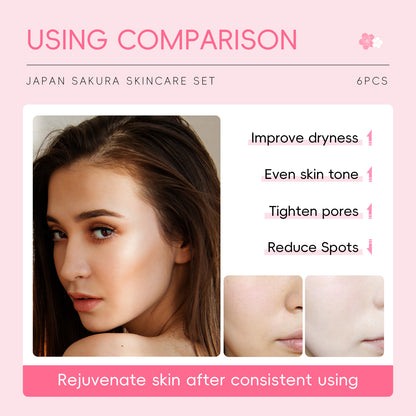 Cherry Blossom Skincare Six-piece Set